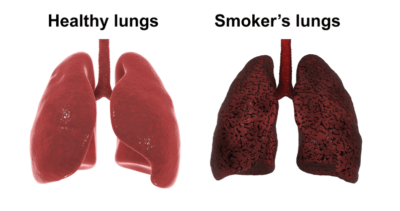 10 Tips on How to Clean Lungs After Smoking | Healeo Nutrition