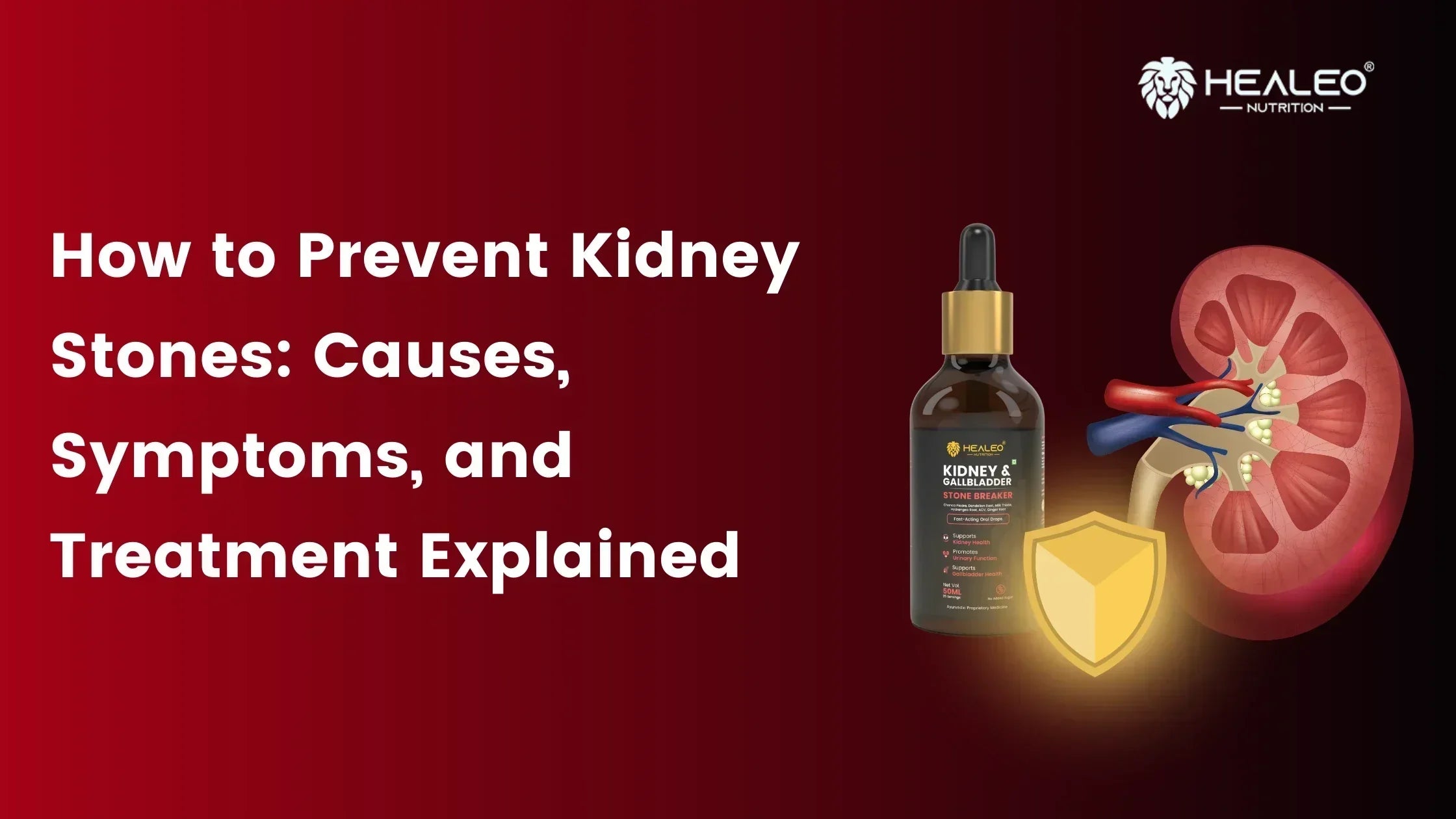 How to Prevent Kidney Stones: Causes, Symptoms, and Treatment Explained ...