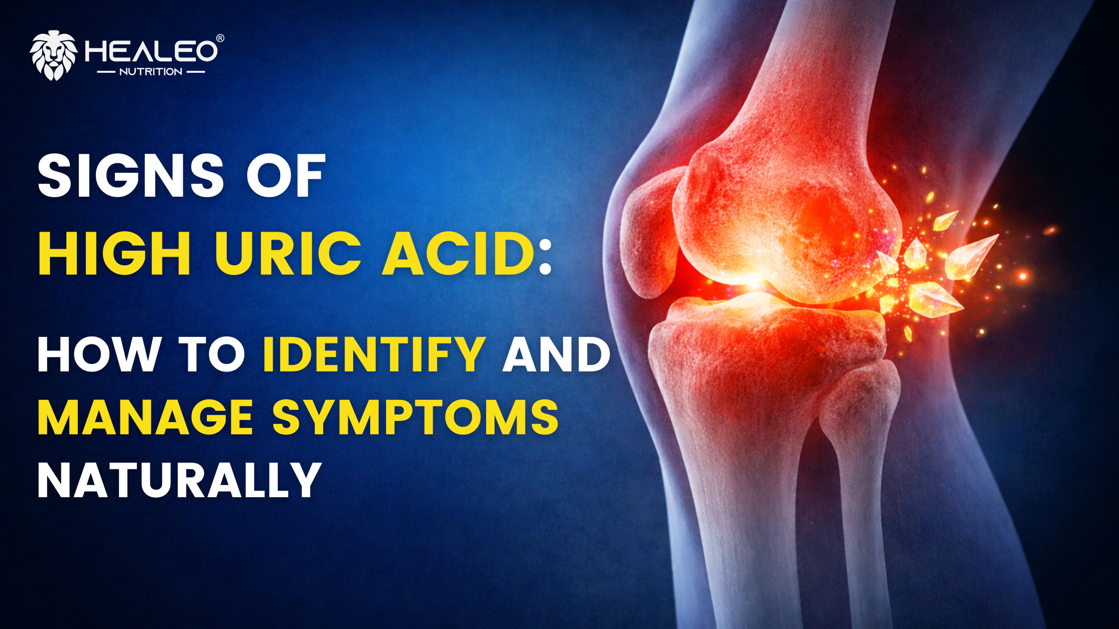 Signs of High Uric Acid: How to Identify and Manage Symptoms Naturally ...