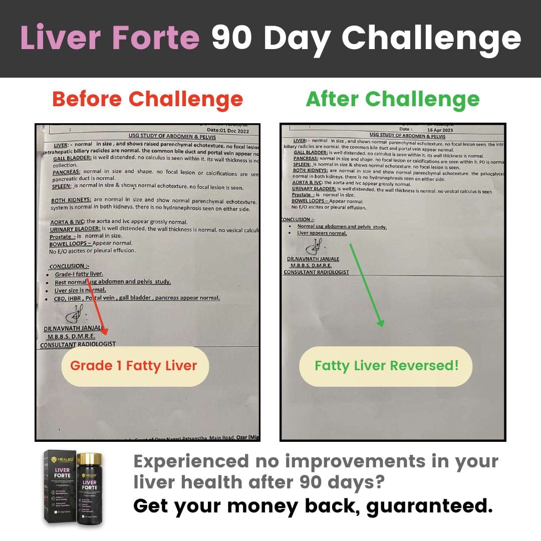 90 Day Fatty Liver Detox Challenge