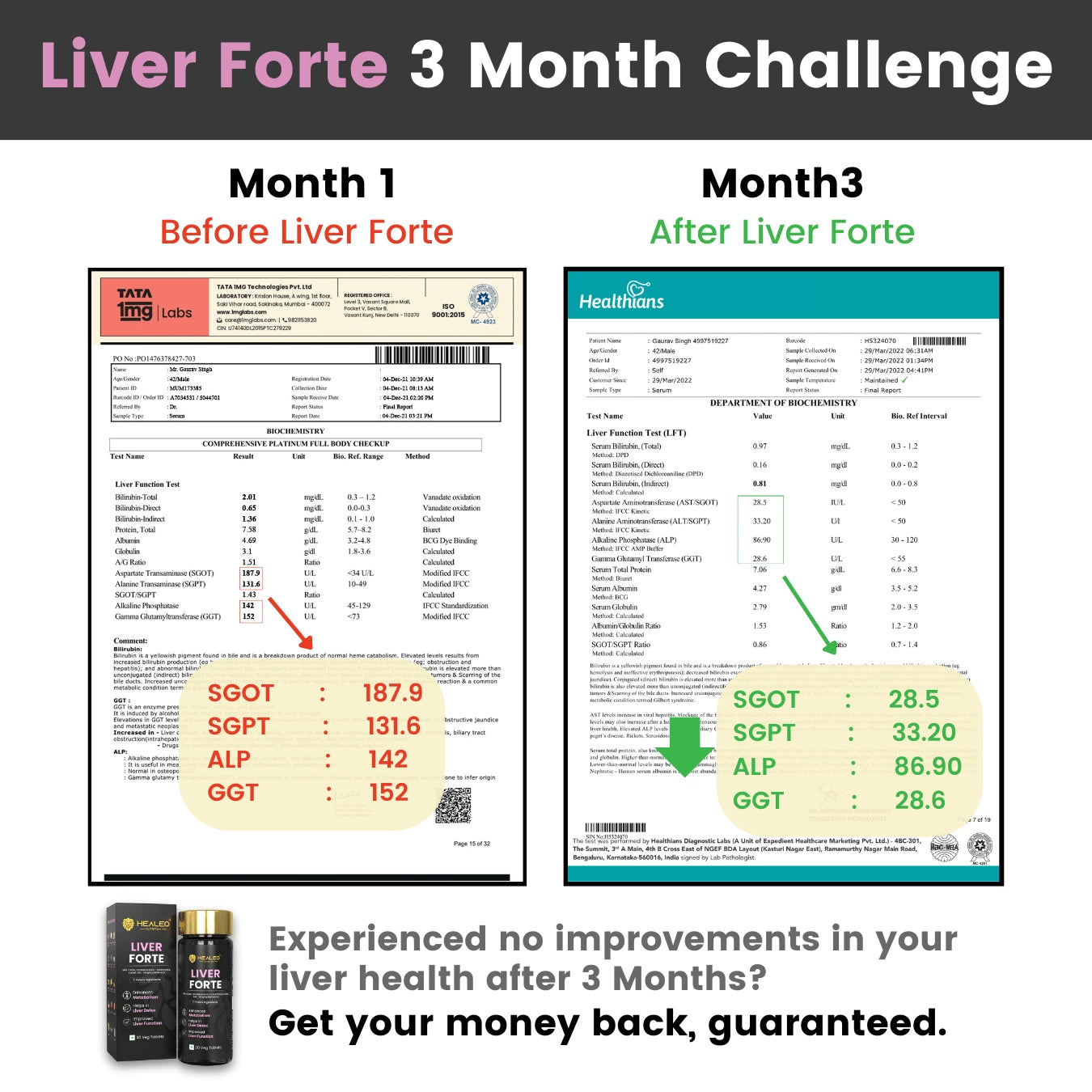 Liver Forte