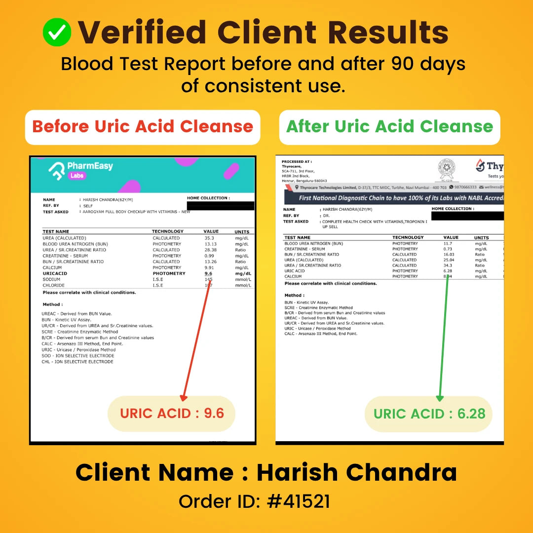 Uric Acid Cleanse Drops