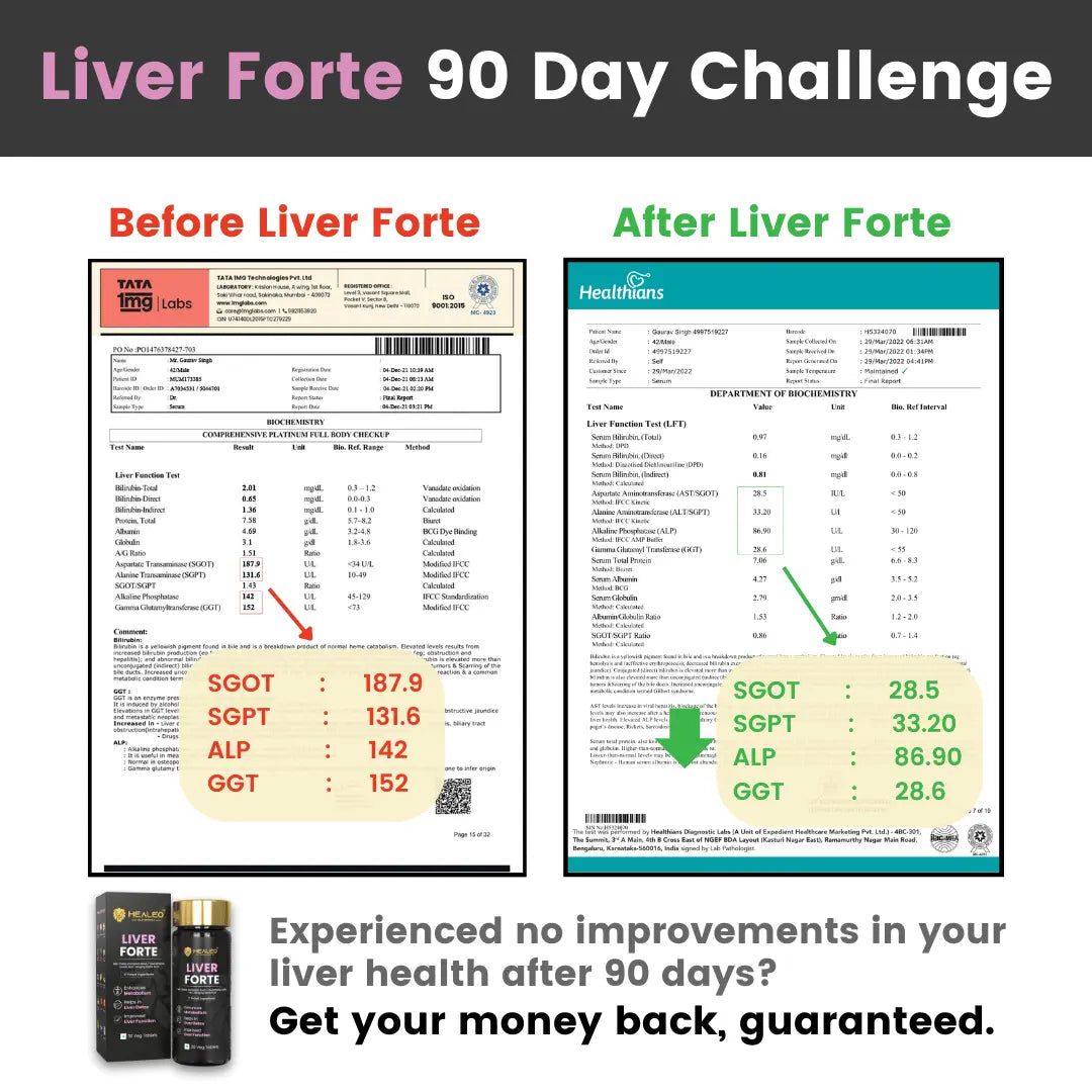 90 Day Fatty Liver Detox Challenge