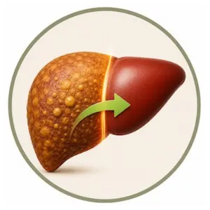 Reverse Fatty Liver